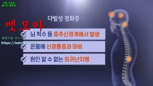 벳모아, 무료 스포츠 중계, 고화질 스포츠 중계, 실시간 스포츠 중계, 꽁머니